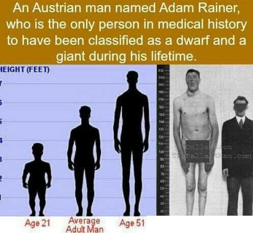 Adam Rainer, the Giant Dwarf