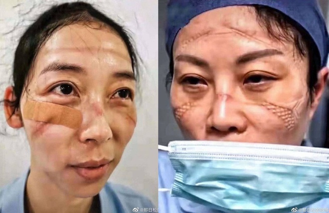 A nurse in Wuhan after their shifts. When PPE strikes back...