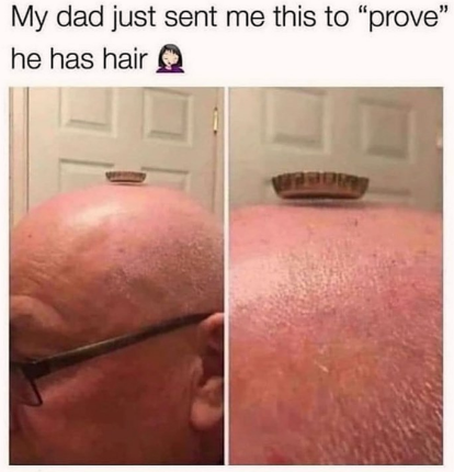 your dad has hair