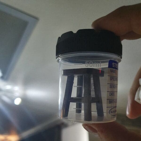 stool sample