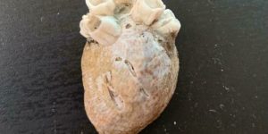someone found this shell at the beach with barnacles around it that make it look like a heart